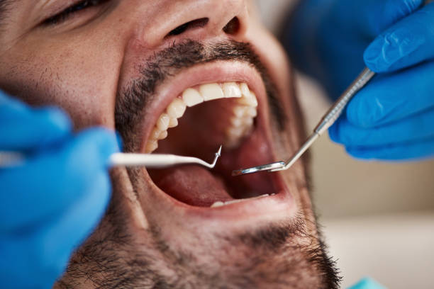 Best Broken or Chipped Tooth Repair in Waelder, TX