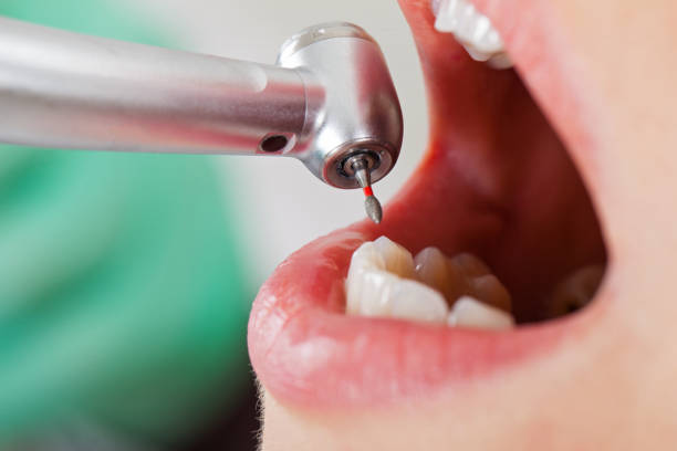 Trusted TX Emergency Dental Service Experts